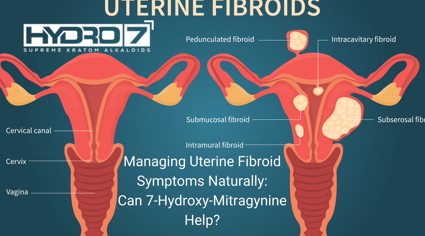 Managing Uterine Fibroid Symptoms Naturally: Can 7-Hydroxy-Mitragynine Help?